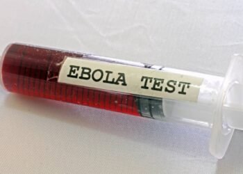 Surto de Ebola em 2026: veja as recomendações da Anvisa para viajantes