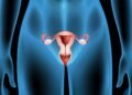 Câncer de endométrio: quais os sinais que o corpo dá e como prevenir