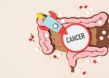 Como funciona o tratamento contra o câncer de intestino