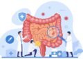 Câncer de intestino: 7 sinais de alerta que você nunca deve ignorar