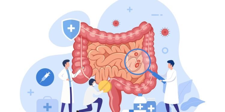Câncer de intestino: 7 sinais de alerta que você nunca deve ignorar