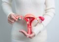 Endometriose: 7 sintomas que vão muito além da cólica e você deve saber