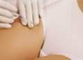 Estética íntima: o que é, como funciona e quais os riscos do tratamento?