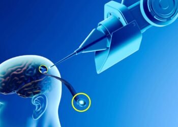 Neuralink: o que é e como funciona o chip cerebral de Elon Musk
