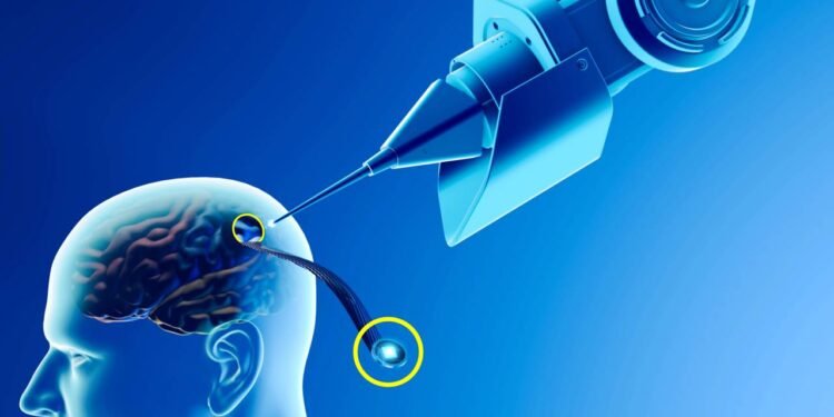 Neuralink: o que é e como funciona o chip cerebral de Elon Musk