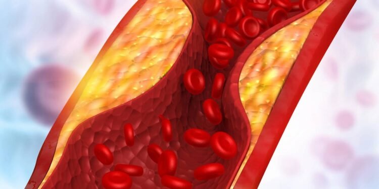 Inibidores de PCSK9: como funciona novo remédio para o colesterol