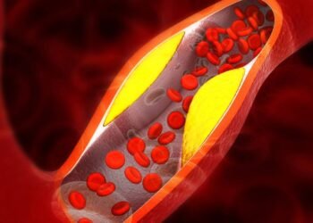 7 alimentos que ajudam a baixar o colesterol ruim (LDL) naturalmente