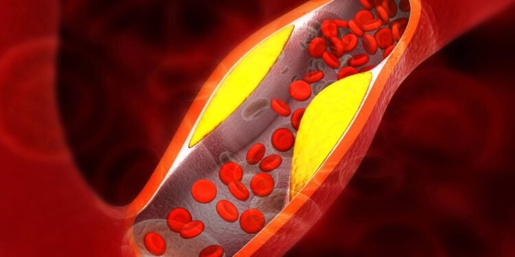 7 alimentos que ajudam a baixar o colesterol ruim (LDL) naturalmente