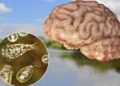 Naegleria fowleri no Brasil: entenda os riscos da 'ameba comedora de cérebro'