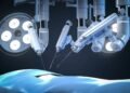 Cirurgia robótica vs laparoscopia: qual a diferença no tratamento