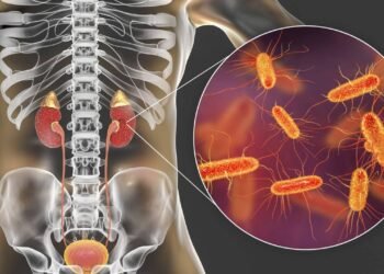7 sinais de que sua infecção urinária pode estar nos rins