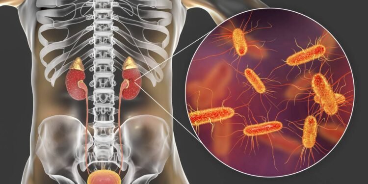 7 sinais de que sua infecção urinária pode estar nos rins