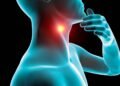 Neoplasia cervical: sintomas, tratamento e chances de cura da doença