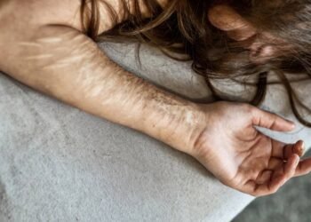 Como identificar sinais de automutilação e sofrimento mental em jovens