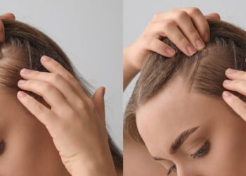 5 dicas para estimular o crescimento do cabelo Créditos: depositphotos.com / serezniy