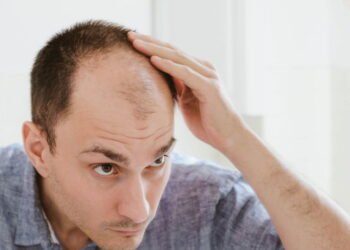 Consumir essa bebida aumenta 57% chance de calvície nos homens