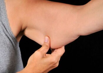 Como acabar definitivamente com a "gordurinha" dos braços?