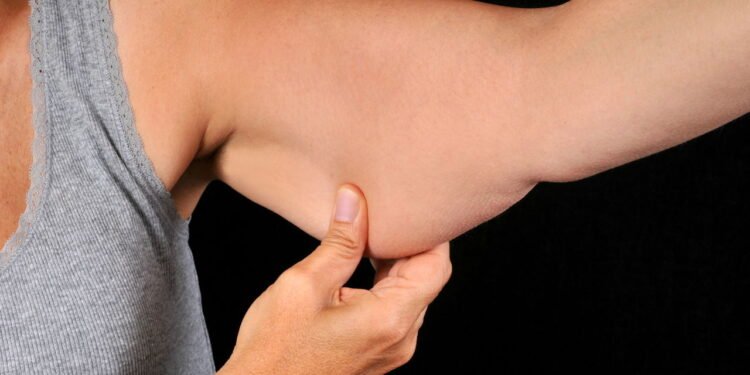 Como acabar definitivamente com a "gordurinha" dos braços?