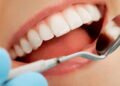 Dicas essenciais para clarear os seus dentes!