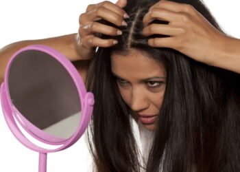 Tudo Sobre Caspa: Causas, Prevenção e Tratamento