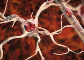 Quem tem Esclerose Múltipla pode fazer isso para ter um alívio nos sintomas