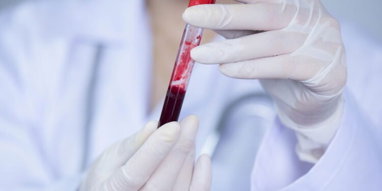 Quem tem esse tipo sanguíneo pode viver mais e envelhecer mais devagar