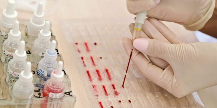 Pessoas com esse tipo sanguíneo podem viver mais e envelhecer mais devagar