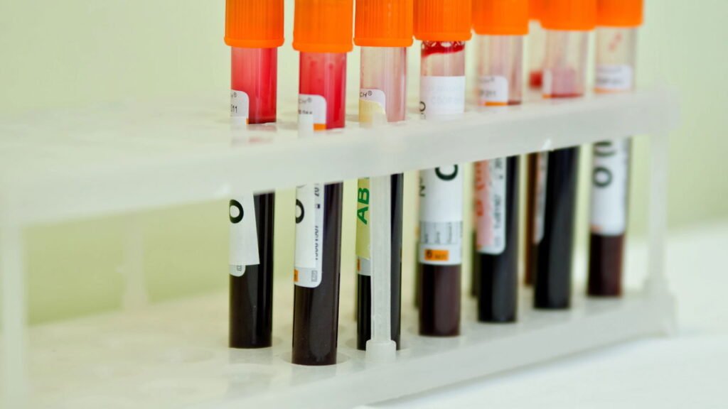 Pessoas com esse tipo sanguíneo podem viver mais e envelhecer mais devagar