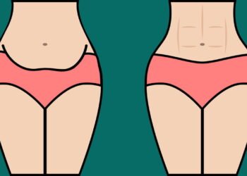 5 Chás naturais para Secar a Barriga com saúde