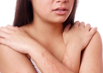 O que leva um jovem à Autolesão? Saiba identificar