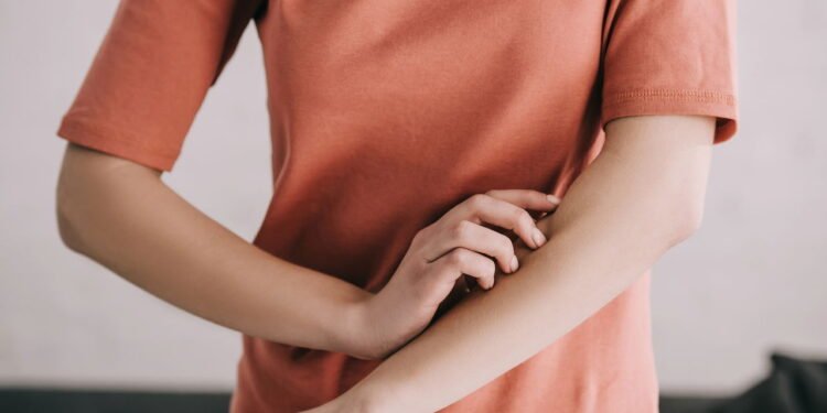 Alergia - Créditos: depositphotos.com / AndrewLozovyi