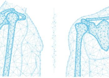 Exercícios que vão fortalecer braços e ombros e levam apenas 15 minutos