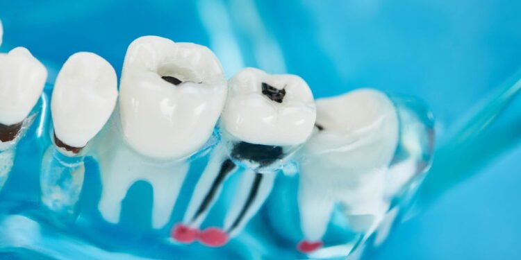 isso pode destruir seus dentes antes mesmo de doer - Créditos: depositphotos.com / VadimVasenin