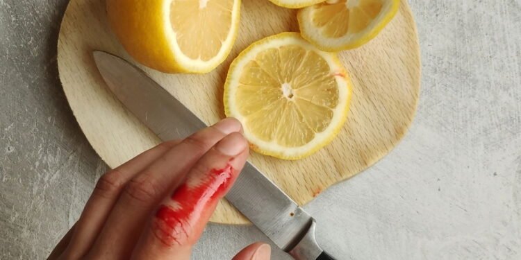 corte no dedo pode parecer leve, mas esconder algo grave - Créditos: depositphotos.com / maya_shustov