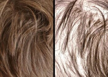 O que fazer para o cabelo crescer rápido? Confira dicas!