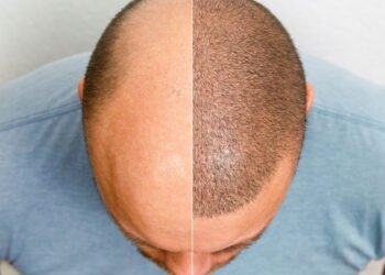 O segredo mais poderoso para o cabelo crescer mais rápido