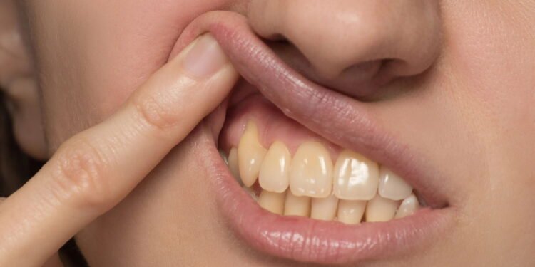 os 5 vilões que deixam seu sorriso amarelado - Créditos: depositphotos.com / Vox19