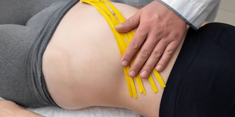 Mulheres podem realizar esses exercícios para ajudar na melhora da diástase abdominal