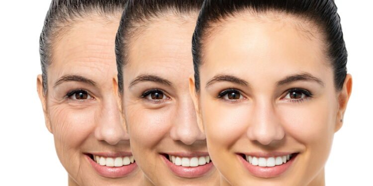 Envelhecimento - Créditos: depositphotos.com / karelnoppe