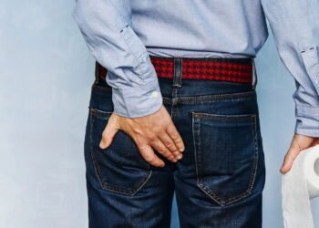 Os melhores remédios para Hemorroidas e quando procurar um médico