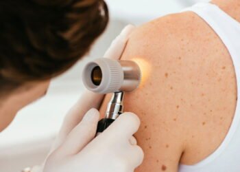 Não é igual para todos! As distinções cruciais do Câncer de Pele em homens e mulheres