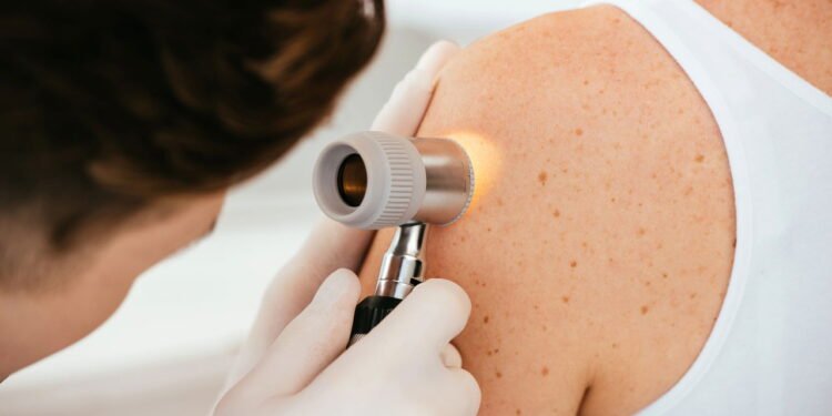 Você está se protegendo do câncer de pele da forma certa? - Créditos: depositphotos.com / AndrewLozovyi