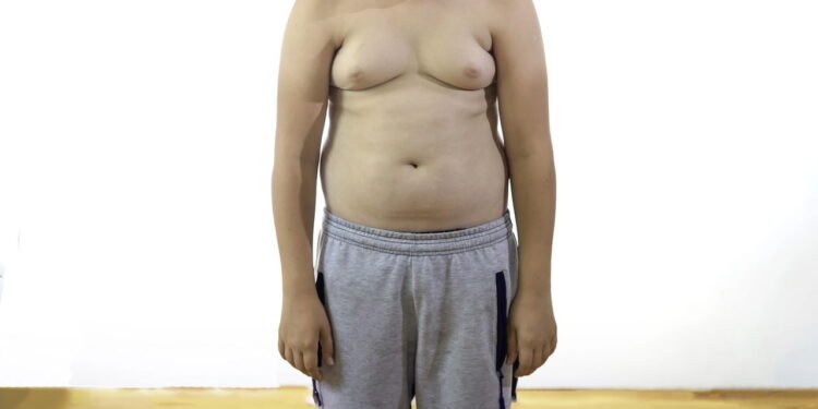 Obesidade - Créditos: depositphotos.com / Zaleskyphoto