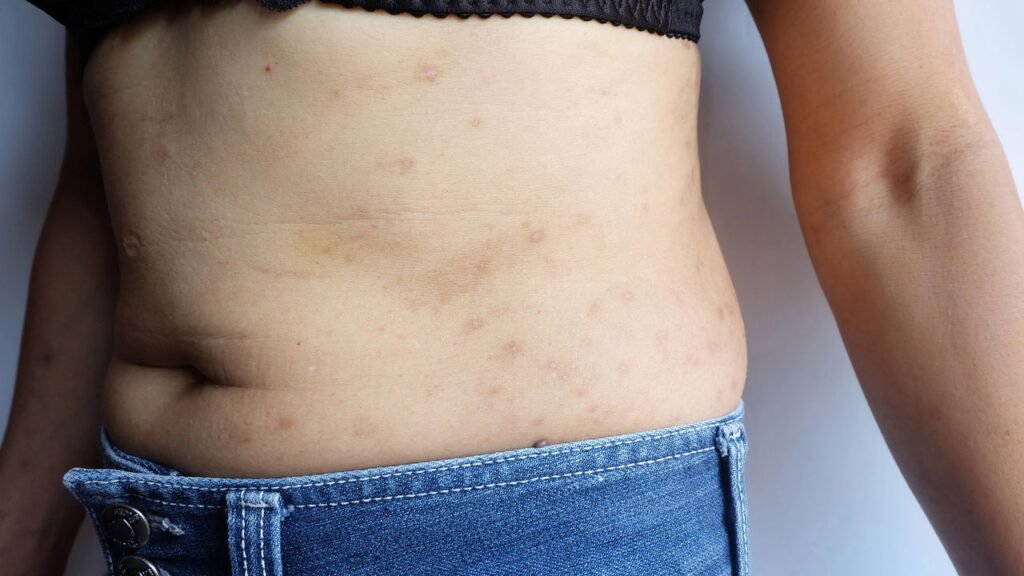 Esse tipo de pele é comum e precisa de cuidados especiais que talvez você não conheça