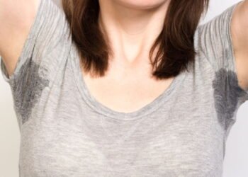 Suor em Excesso nas axilas, mãos ou rosto? Entenda as causas e soluções