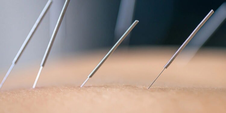 A técnica pouco conhecida que tem mais de 3.000 anos e ainda pode te ajudar muito