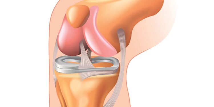 5 sinais de que os estalos nos joelhos não são tão inofensivos assim