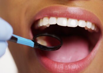 O problema silencioso que aparece na boca e como resolver com 5 alimentos