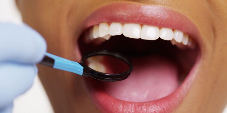 O problema silencioso que aparece na boca e como resolver com 5 alimentos