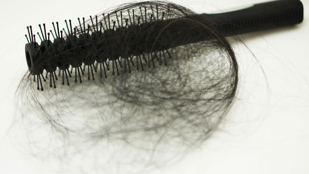 Seus fios estão caindo mais do que o normal? Isso pode ser um sinal sério